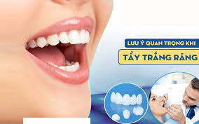 Những lưu ý khi tẩy trắng răng