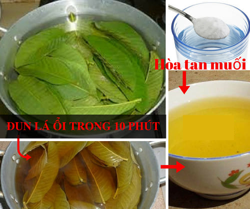 Lá ổi là mẹo trị hôi miệng hiệu quả tại nhà được nhiều người áp dụng